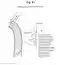 Fig. 17 - High Flow Embolic Protection Device