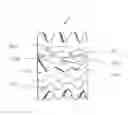 Fig. 01 - VASCULAR FILTER STENT
