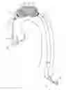 Fig. 01 - PERCUTANEOUS EMBOLI PROTECTION SLEEVE