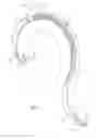 Fig. 02 - PERCUTANEOUS EMBOLI PROTECTION SLEEVE