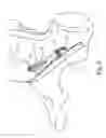 Fig. 07 - INSERTION OF AN ARTIFICIAL LIGAMENT
