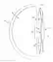 Fig. 01 - VISION CORRECTION SYSTEM