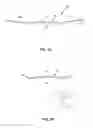 Fig. 02 - VISION CORRECTION SYSTEM