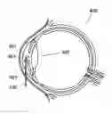 Fig. 01 - Apparatus for the treatment of cataract