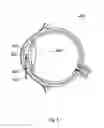 Fig. 07 - Apparatus for the treatment of cataract