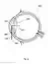 Fig. 09 - Apparatus for the treatment of cataract