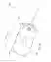 Fig. 14 - Methods and apparatuses for deploying minimally-invasive heart valves