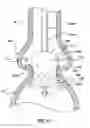 Fig. 10 - Segmented transcatheter valve prosthesis having an unsupported valve segment