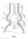 Fig. 12 - Segmented transcatheter valve prosthesis having an unsupported valve segment