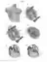 Fig. 04 - VALVE PROSTHESIS