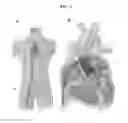 Fig. 05 - VALVE PROSTHESIS