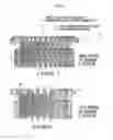 Fig. 07 - VALVE PROSTHESIS