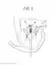 Fig. 05 - Truncated cone heart valve stent