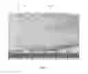 Fig. 02 - Fenestrated bone graft