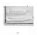 Fig. 03 - Tasseled bone graft