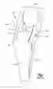 Fig. 02 - Implants/procedures related to tibial tuberosity advancement