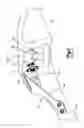 Fig. 03 - Implants/procedures related to tibial tuberosity advancement