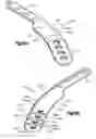 Fig. 15 - Implants/procedures related to tibial tuberosity advancement