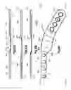 Fig. 16 - Implants/procedures related to tibial tuberosity advancement