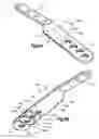 Fig. 18 - Implants/procedures related to tibial tuberosity advancement
