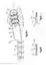 Fig. 20 - Implants/procedures related to tibial tuberosity advancement