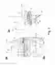 Fig. 03 - Knee prosthesis