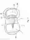 Fig. 12 - Knee prosthesis