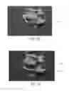 Fig. 11 - Intervertebral cage for spinal implant
