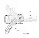 Fig. 11 - MODULAR INTERVERTEBRAL CAGE SYSTEM