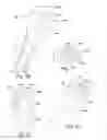 Fig. 12 - Methods and devices for bone preparation