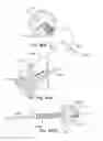 Fig. 23 - Methods and devices for bone preparation