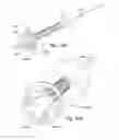 Fig. 24 - Methods and devices for bone preparation