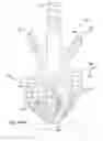 Fig. 28 - Methods and devices for bone preparation