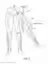 Fig. 06 - LOWER EXTREMITY EXOSKELETON FOR GAIT RETRAINING