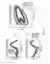 Fig. 13 - LOWER EXTREMITY EXOSKELETON FOR GAIT RETRAINING