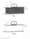 Fig. 05 - Stent with outer member to embolize an aneurysm