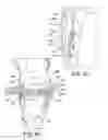 Fig. 16 - Orthopedic device for dynamically treating the knee