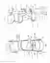 Fig. 02 - Orthopedic device having a dynamic control system and method for using the same