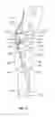 Fig. 07 - Orthopedic device having a dynamic control system and method for using the same
