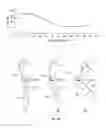 Fig. 14 - Orthopedic device having a dynamic control system and method for using the same