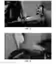 Fig. 06 - Treatment of spinal deformities