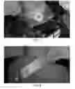 Fig. 07 - Treatment of spinal deformities