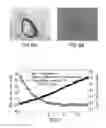 Fig. 04 - SYSTEM, METHOD AND ARRANGEMENTS FOR MODIFYING OPTICAL AND MECHANICAL PROPERTIES OF BIOLOGICAL TISSUES
