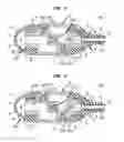 Fig. 08 - External ear canal pressure regulation device