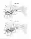 Fig. 10 - External ear canal pressure regulation device