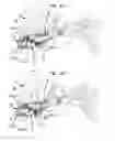 Fig. 11 - External ear canal pressure regulation device