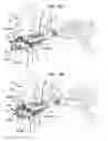 Fig. 12 - External ear canal pressure regulation device