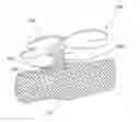 Fig. 01 - Orthopaedic Cast Tacks