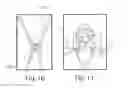 Fig. 11 - POSITIONING DEVICE AND METHOD FOR USE WITH A PATIENT UNDER ANESTHESIA