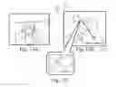 Fig. 15 - POSITIONING DEVICE AND METHOD FOR USE WITH A PATIENT UNDER ANESTHESIA
